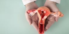 Neue Antikörper-Behandlung gegen Endometriose wirksam