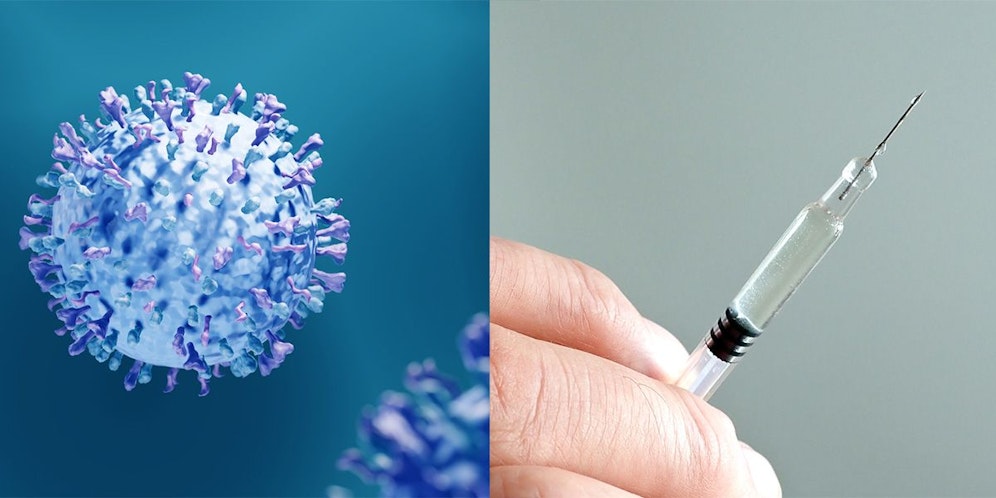 Das RS-Virus (li.) ist ein weltweit verbreiteter Erreger von akuten Erkrankungen der oberen und unteren Atemwege in jedem Lebensalter.