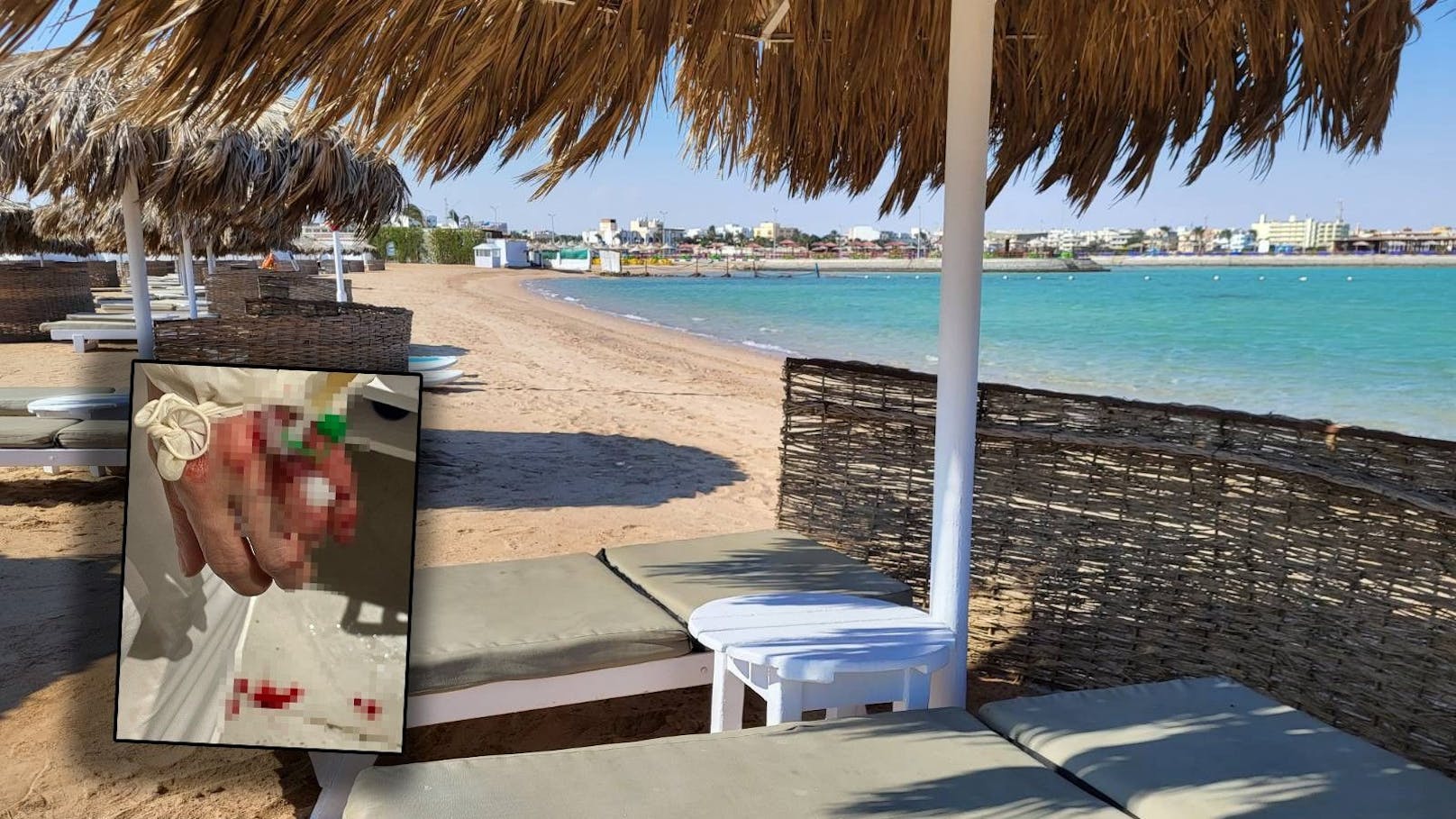 Frau im Hurghada-Urlaub vergiftet: "War am Abkratzen!"