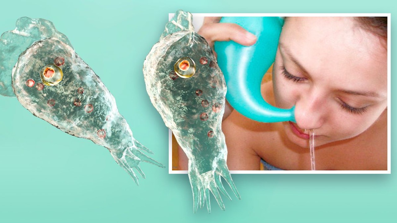 Heute.at - Hirnfressende Amöben töten Mann nach Nasenspülung