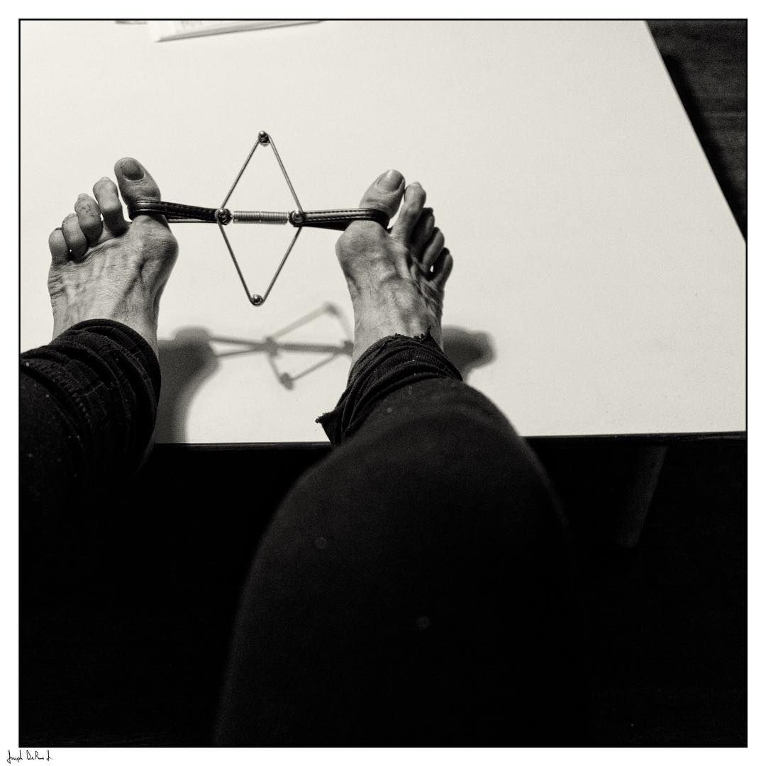 Seinen Ballenzehen (Bild) bereiten Joseph DeRuvo Jr. Schmerzen, wenn er Schuhe trägt. Deshalb lässt er es bleiben.&nbsp;