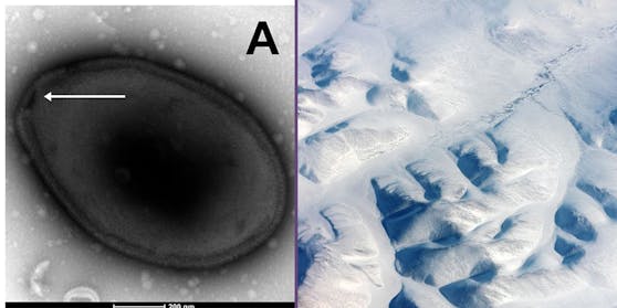 Das "Zombie-Virus" Pandoravirus yedoma (li.) ist ein so genanntes "Riesenvirus", das unter einem normalen Mikroskop sichtbar ist. Es ist 48.500 Jahre alt und stammt aus einer Bodenprobe, die 16 Meter unterhalb eines arktischen Sees genommen wurde.