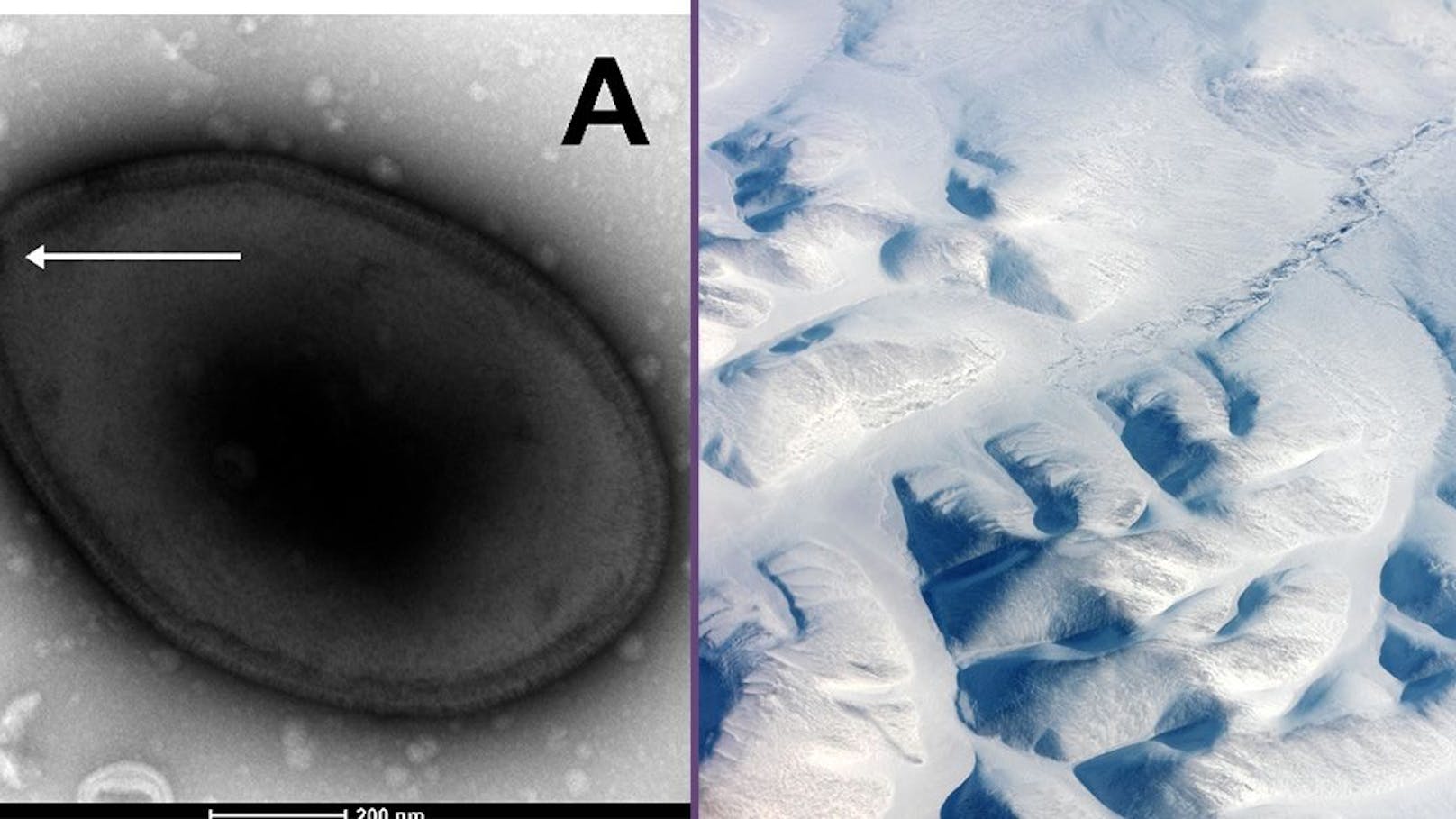 Das "Zombie-Virus" Pandoravirus yedoma (li.) ist ein so genanntes "Riesenvirus", das unter einem normalen Mikroskop sichtbar ist. Es ist 48.500 Jahre alt und stammt aus einer Bodenprobe, die 16 Meter unterhalb eines arktischen Sees genommen wurde.