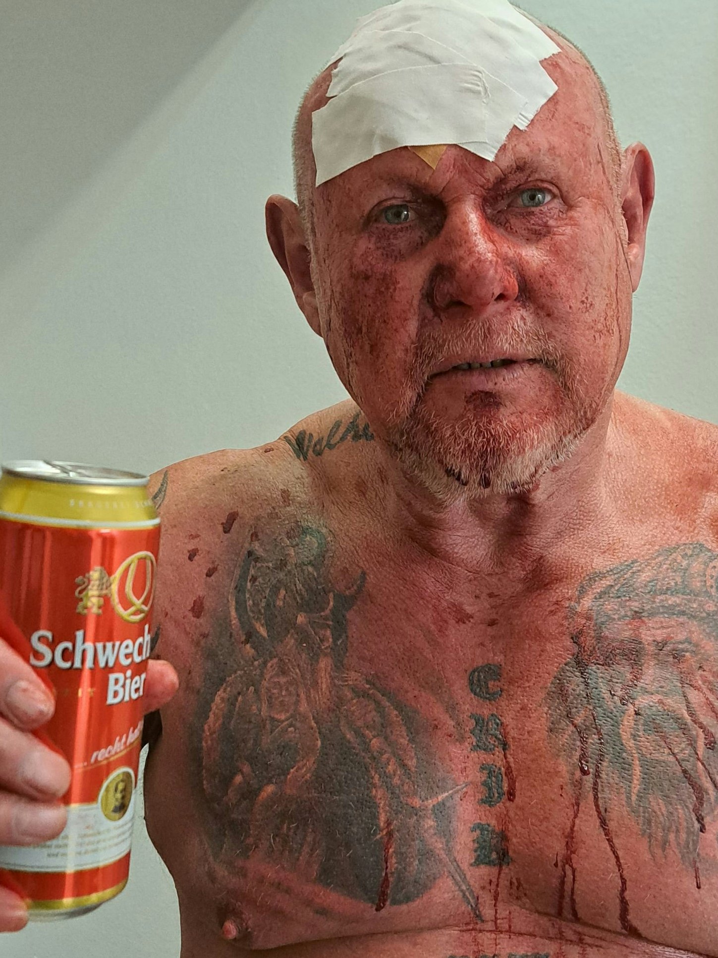 Franz Schlederer nach seinem blutigen Kampf