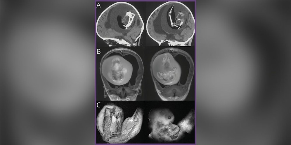 Das äußerst seltene Phänomen des 