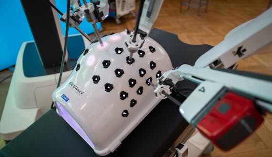 Die OP-Roboter sollen Chirurgen vor allem bei minimal-invasiven Eingriffen unterstützen. Zwei Millionen Euro kostet ein Gerät.