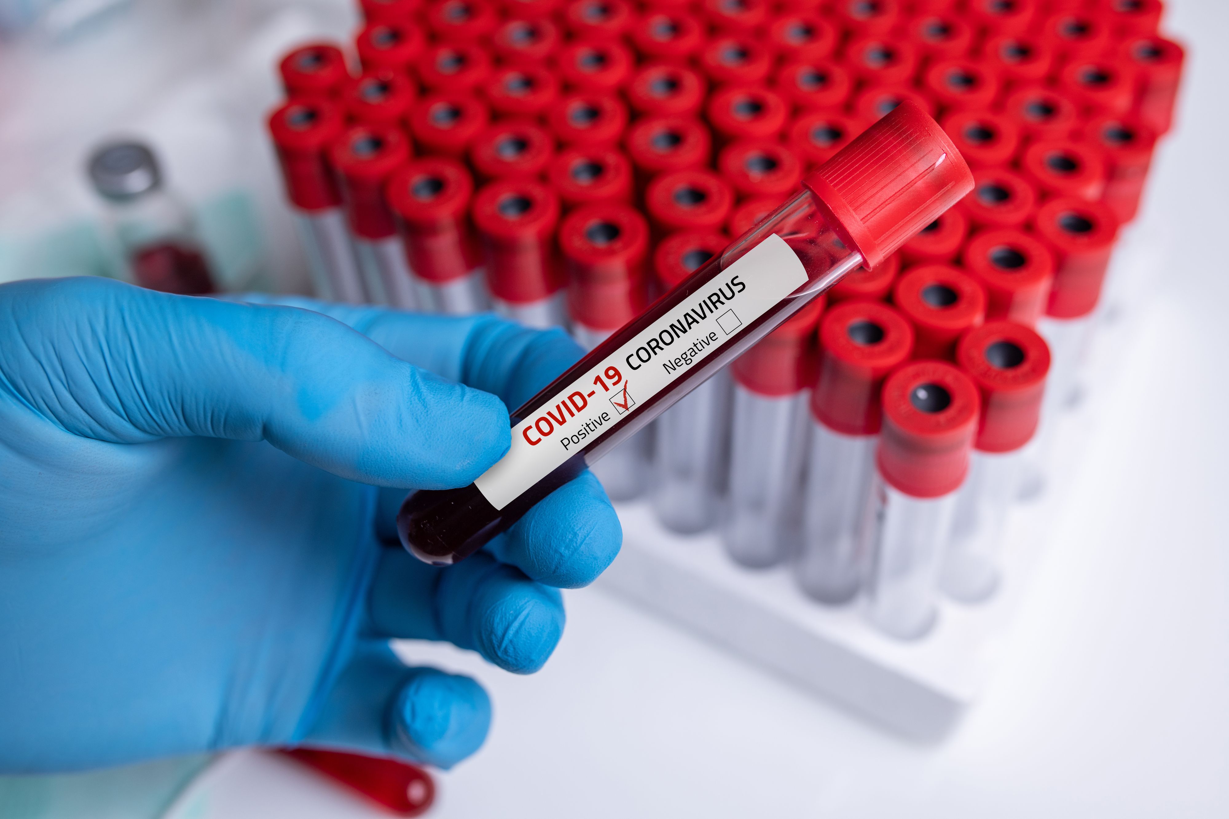 Im Hintergrund von XBB.1.5 baut sich bereits die nächste Omikron-Sublinie auf.