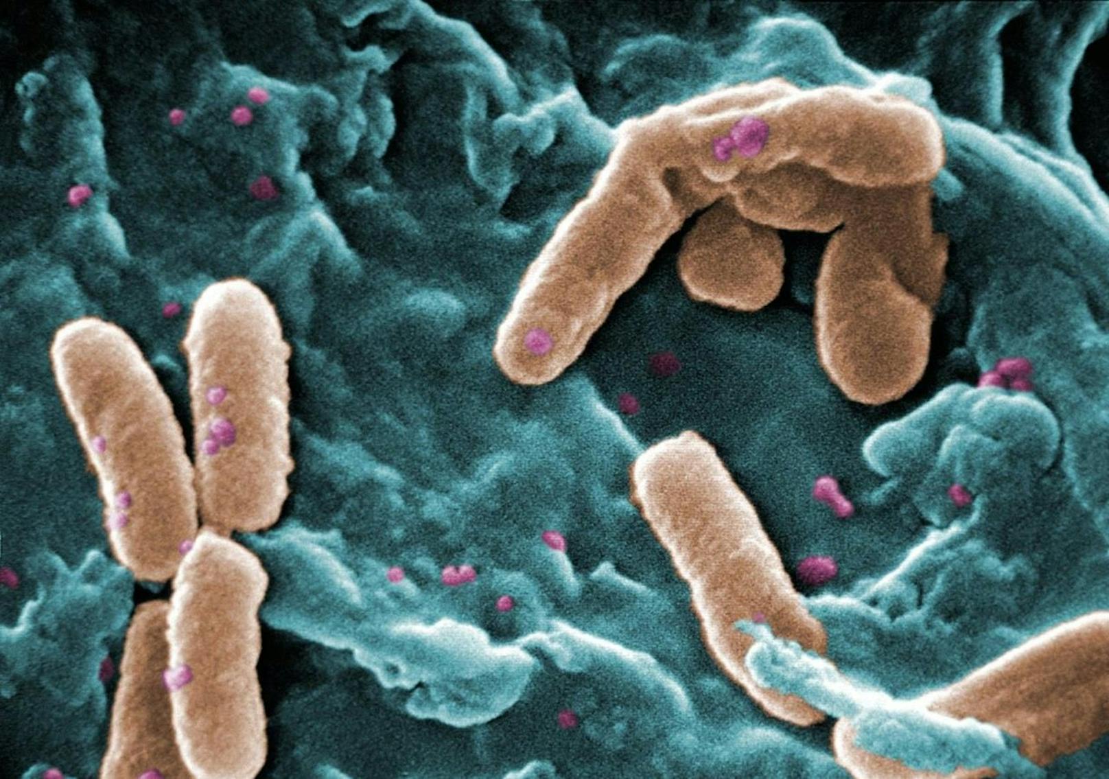Es stellte sich heraus, dass das Produkt mit einem Bakterium namens Pseudomonas aeruginosa kontaminiert war.