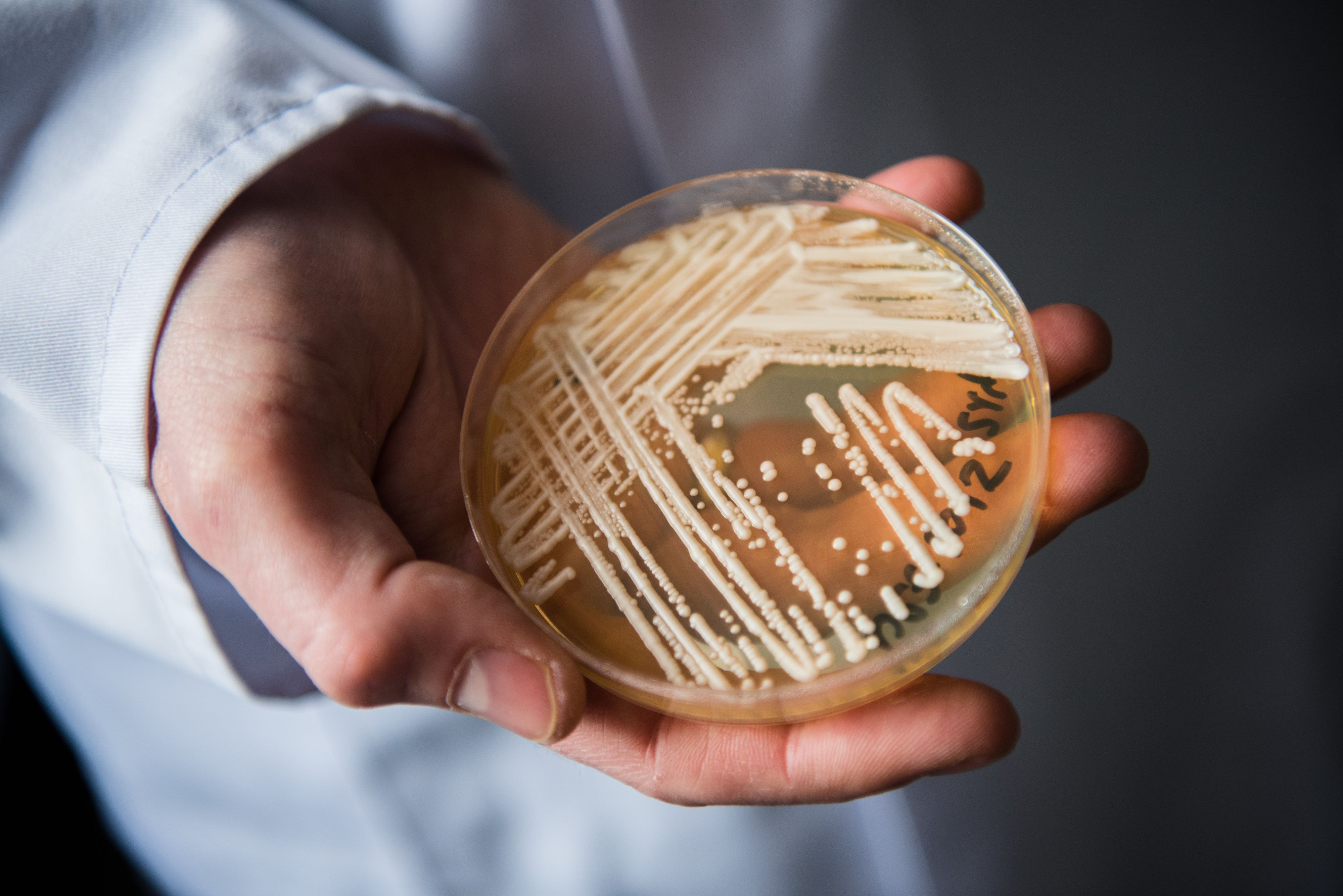 Download von www.picturedesk.com am 27.03.2023 (14:26).  The director of the National Reference Centre for Invasive Fungus Infections, Oliver Kurzai, holding in his hands a petri dish holding the yeast candida auris in a laboratory of Wuerzburg University in Wuerzburg, Germany, 23 January 2018. There has been a recent rise of cases in Germany of seriously ill patients becoming infected with the dangerous yeast candida auris. Photo: Nicolas Armer/dpa - 20180123_PD12449 - Rechteinfo: Rights Managed (RM)