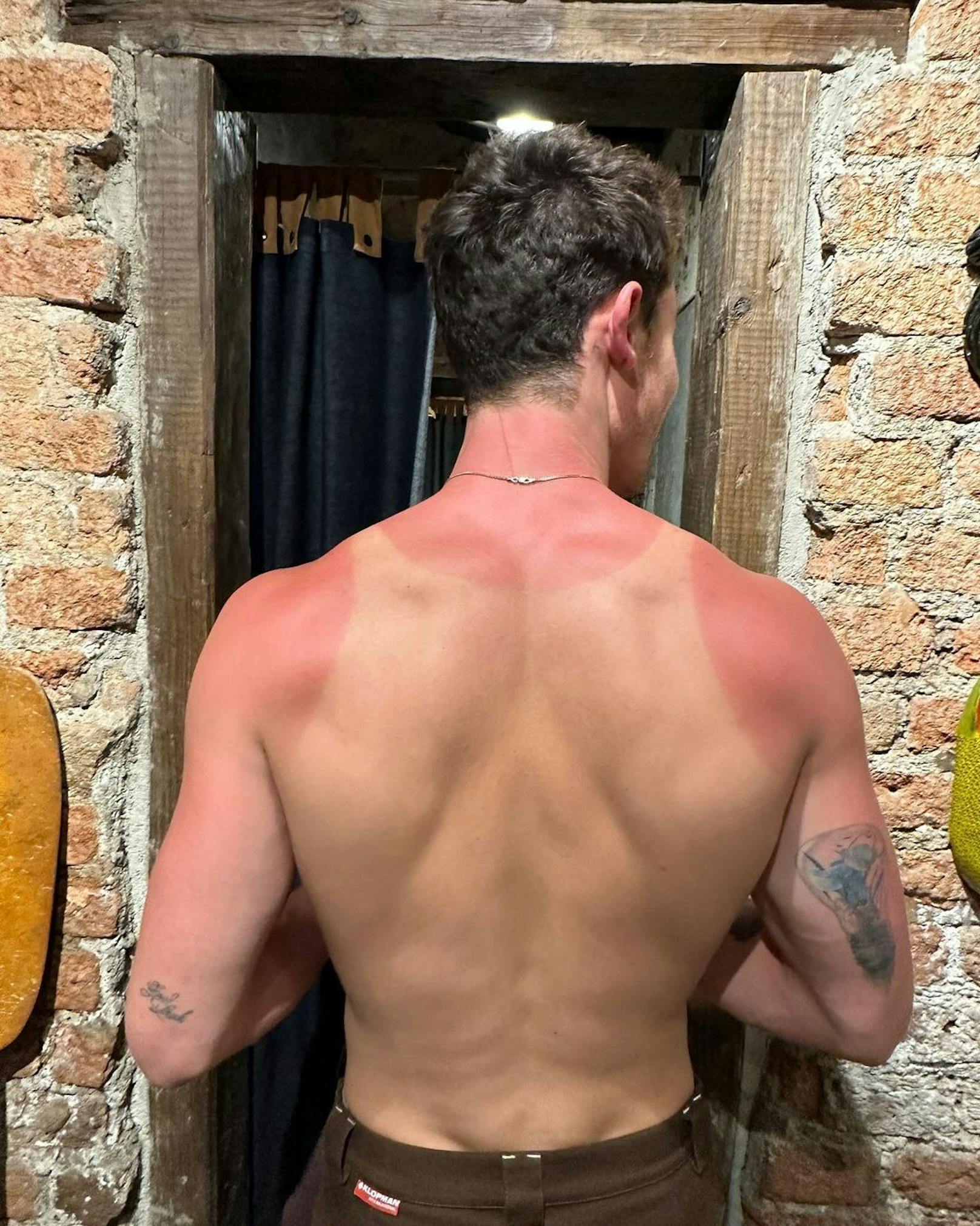 Die Sonne in Mexico City hat Shawn Mendes unterschätzt.