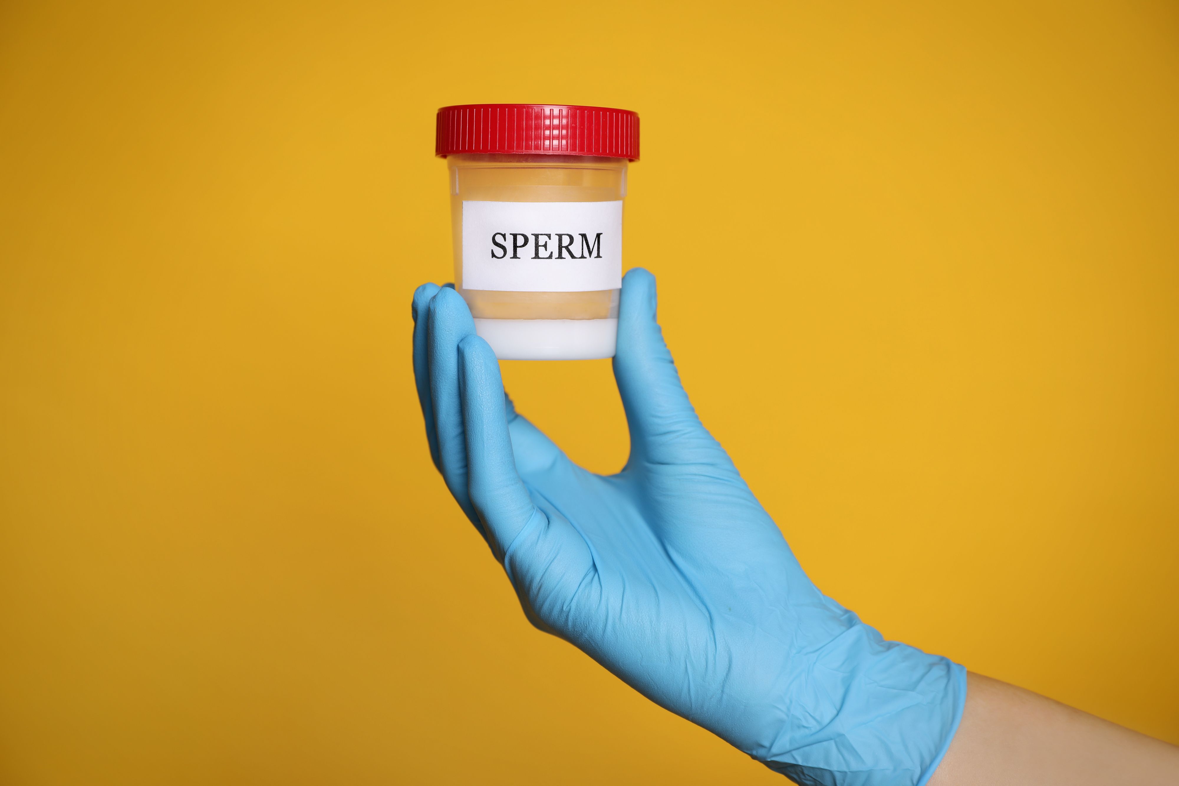 Scientist holding container with sperm on yellow background, closeup