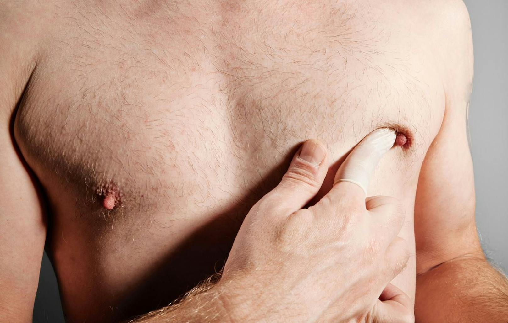 Im frühen Stadium verursacht Brustkrebs meist keine Schmerzen. Auch Männer können durch regelmäßiges Abtasten ihrer Brust etwaige Gewebeunregelmäßigkeiten rechtzeitig entdecken. (Symbolbild)