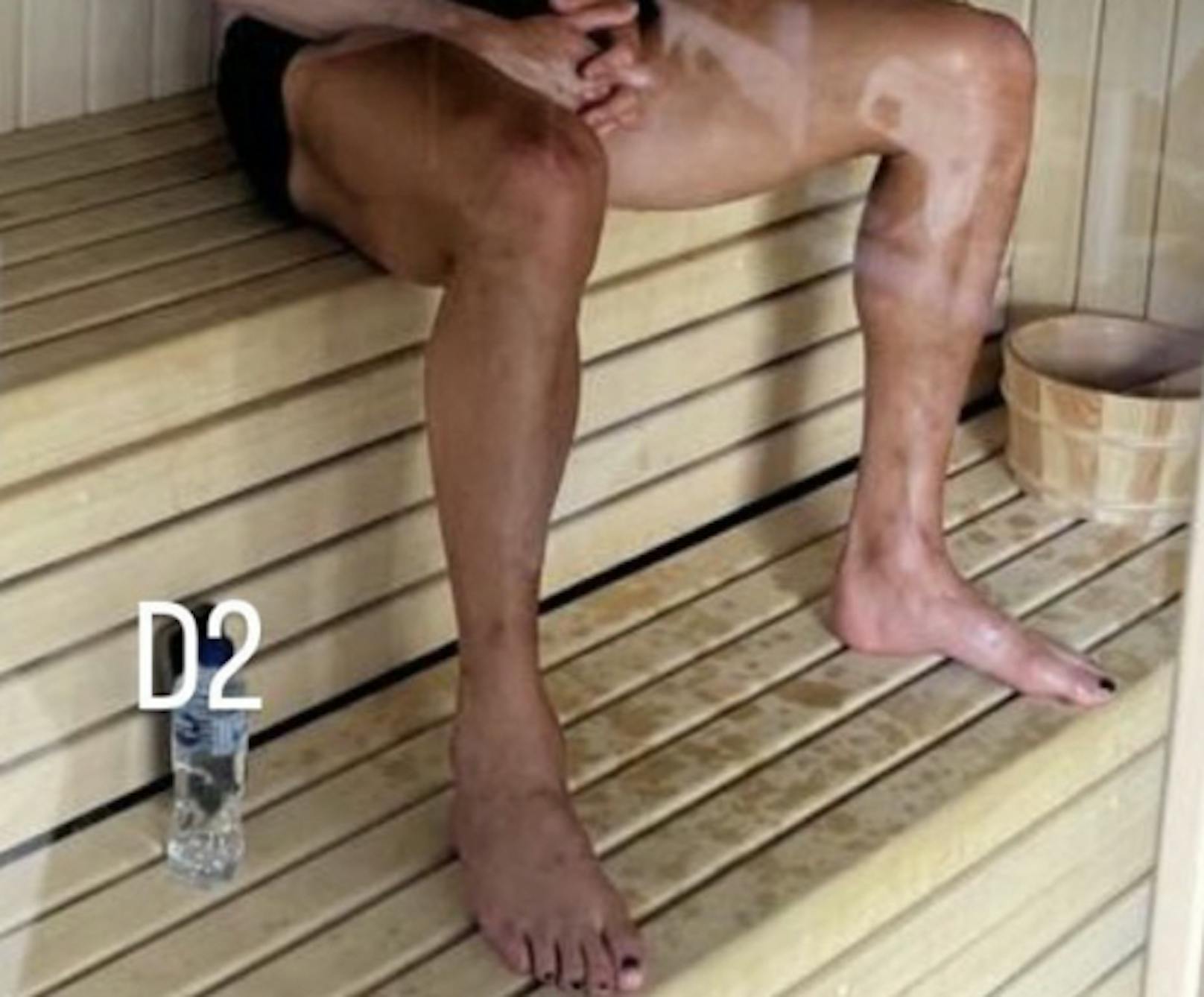 Ronaldo mit lackierten Nägeln.