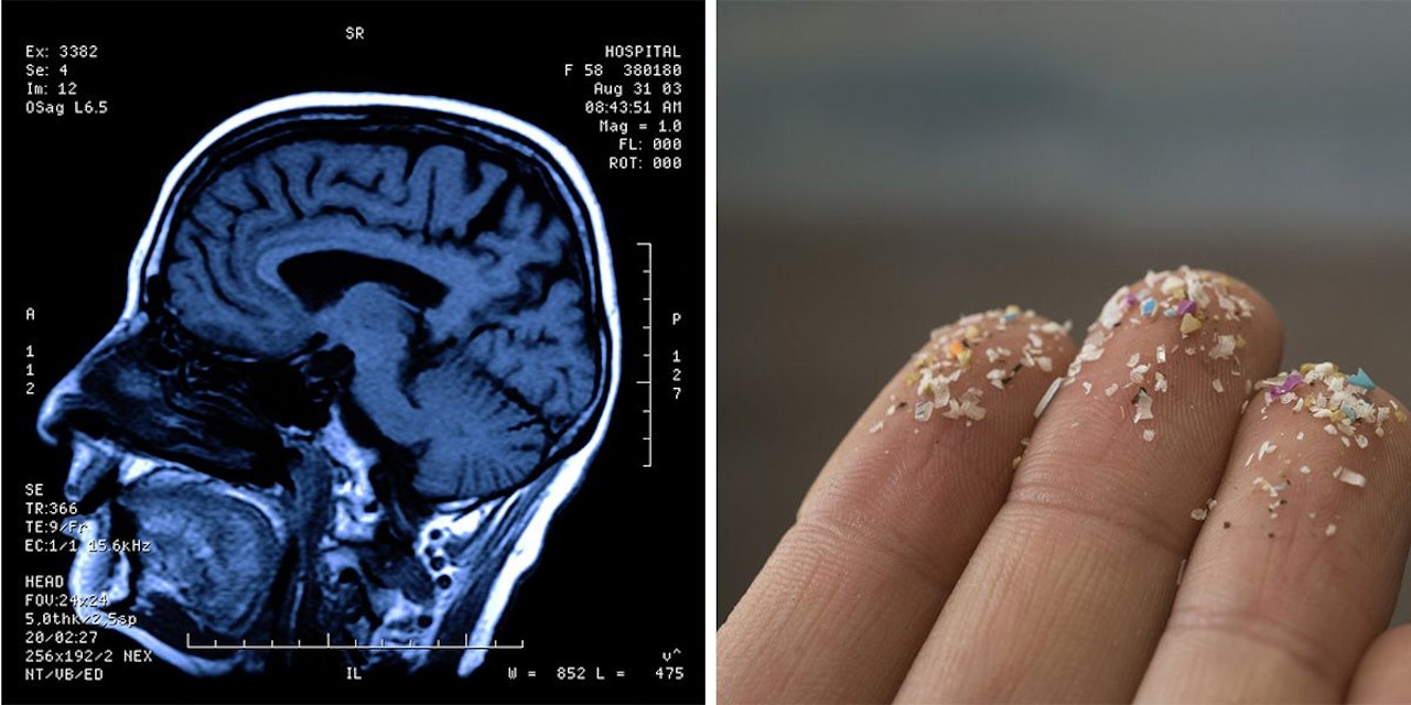 Heute.at - Forscher weisen Mikroplastik nun sogar im Gehirn nach