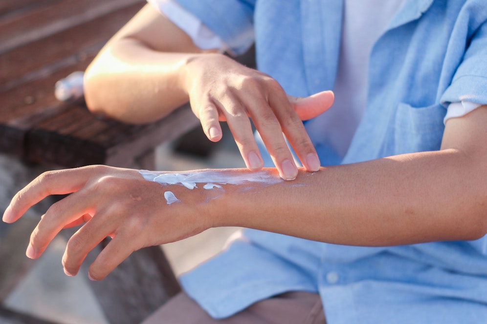Betroffene reagieren auf Sonnenlicht mit starken Schmerzen und manchmal sichtbaren Verbrennungen.