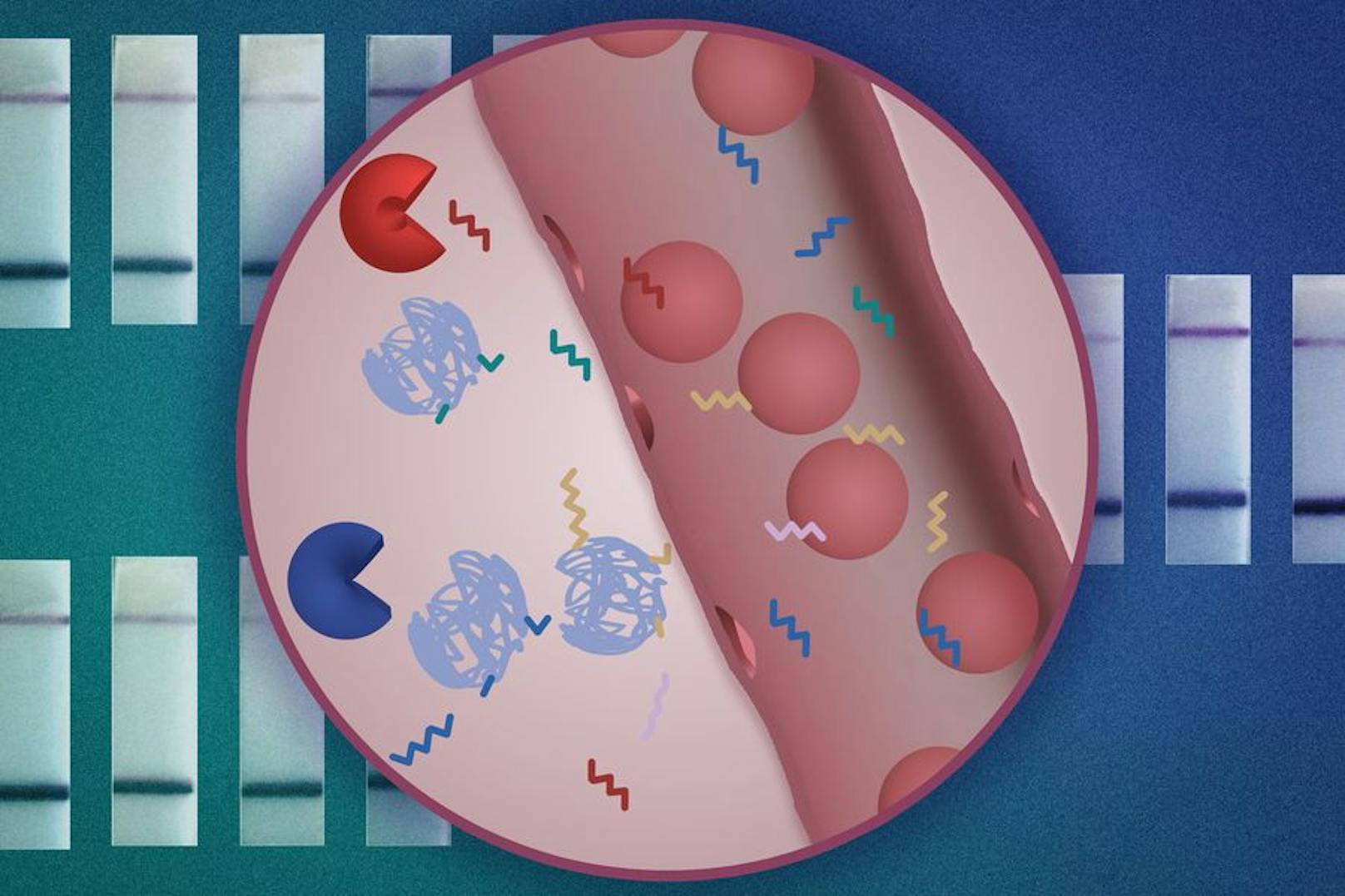MIT-Ingenieure haben einen neuen Nanopartikelsensor entwickelt, der die Krebsdiagnose mit einem einfachen Urintest ermöglichen kann. Die Nanopartikel (blau) tragen DNA-Barcodes (Zickzacklinien), die von krebsassoziierten Proteasen im Körper gespalten werden können (Pac-Man-Formen). Sobald sie gespalten sind, können die DNA-Barcodes in einer Urinprobe nachgewiesen werden.&nbsp;