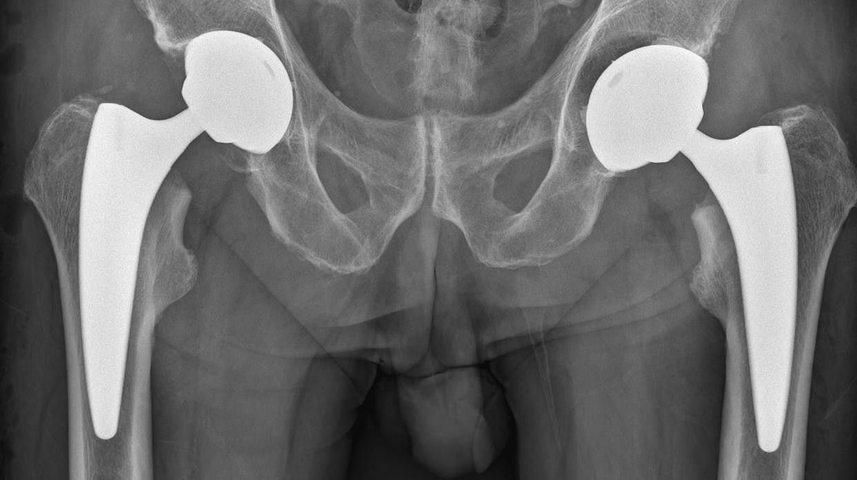 Durch die "Zwettler Hüfte" wurde er bekannt.