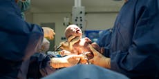 Katastrophaler Unfall – Arzt "köpft" Baby bei Geburt