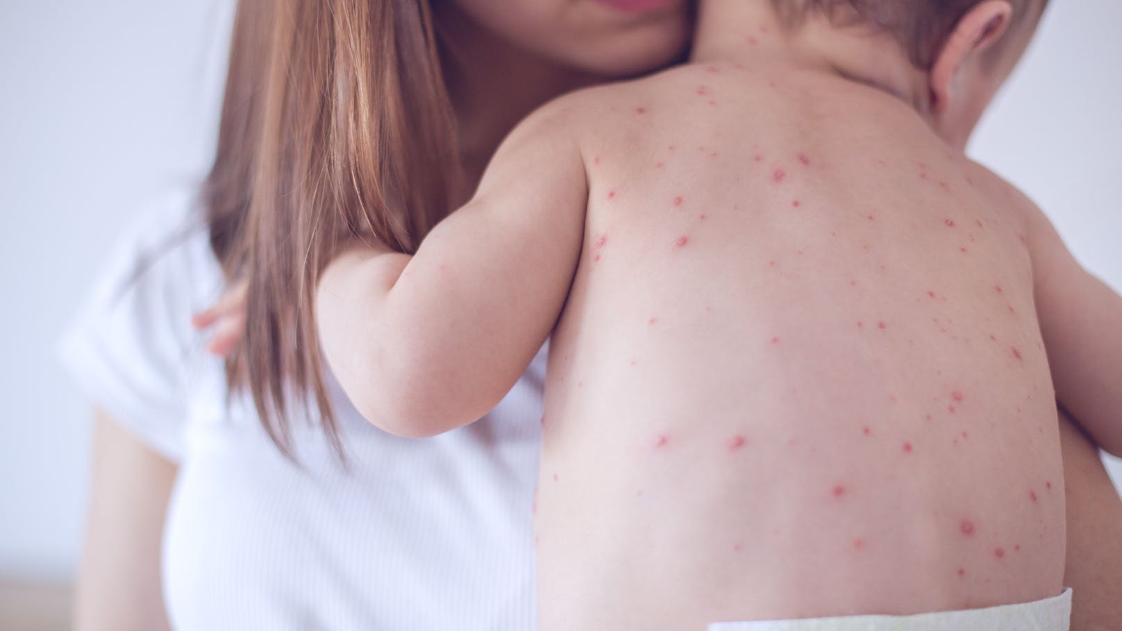 Wieso Eltern ihre Kinder nicht gegen Masern impfen
