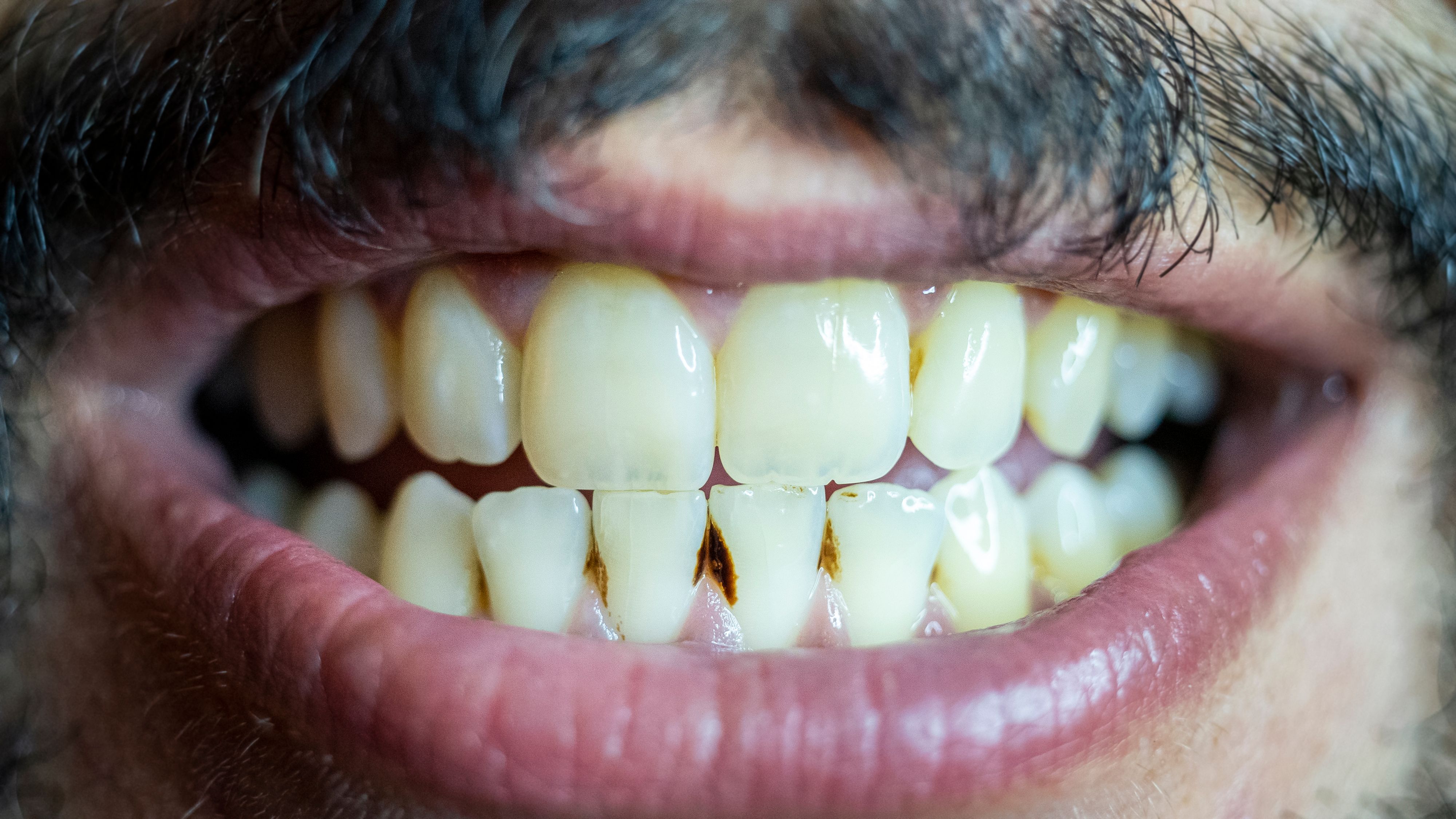 Erst schlug der Angreifer zu, dann folgte eine Baiß-Attacke.