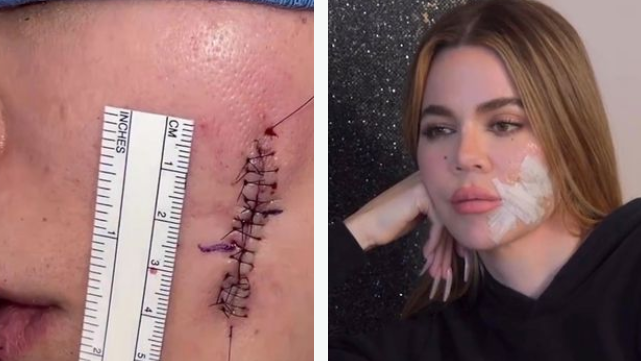 Die dritte Staffel bietet private Einblicke in die Tumor-Entfernung von Khloé Kardashian.