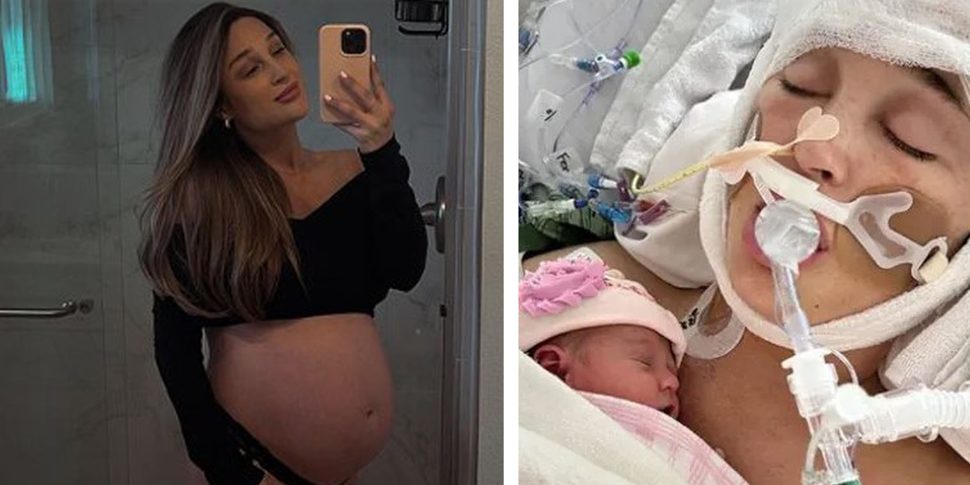 US-Influencerin Jackie Miller befindet sich noch immer im Koma.