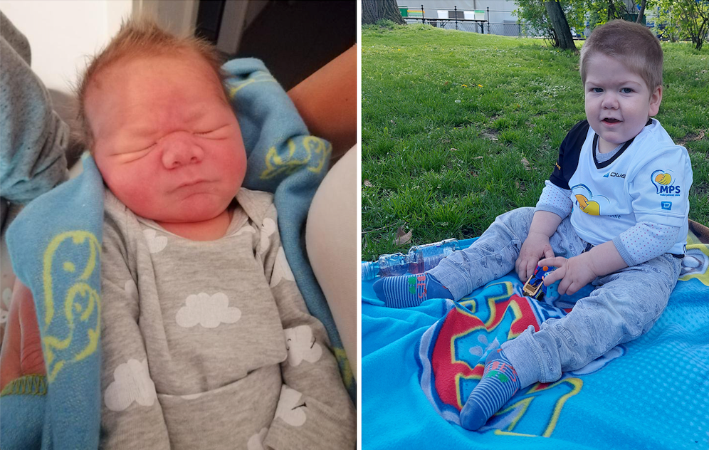 Elias bei der Geburt (l.), der kleine Bub hat eine schwere Form von MPS.