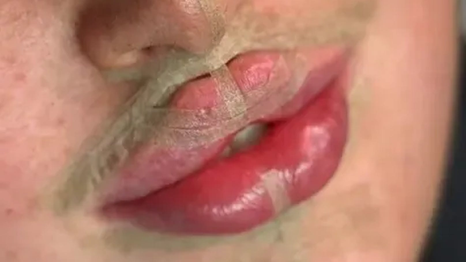 Butterfly-Lips sind der neueste Beauty-Trend, sorgen aber auch für viele kritische Stimmen.&nbsp;