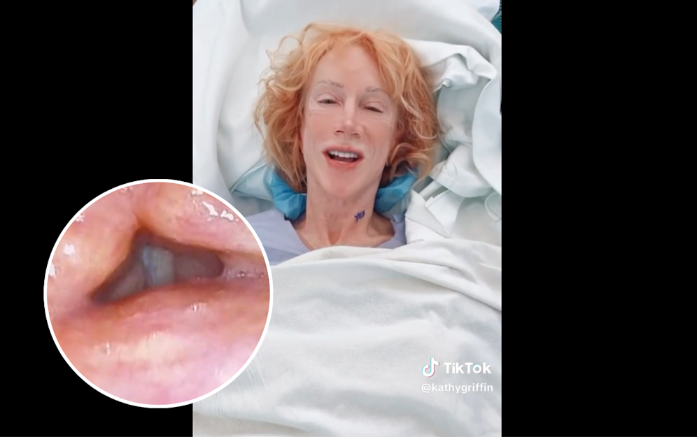 Kathy Griffin kann wieder sprechen - die US-Komikerin hatte eine Stimm-OP.