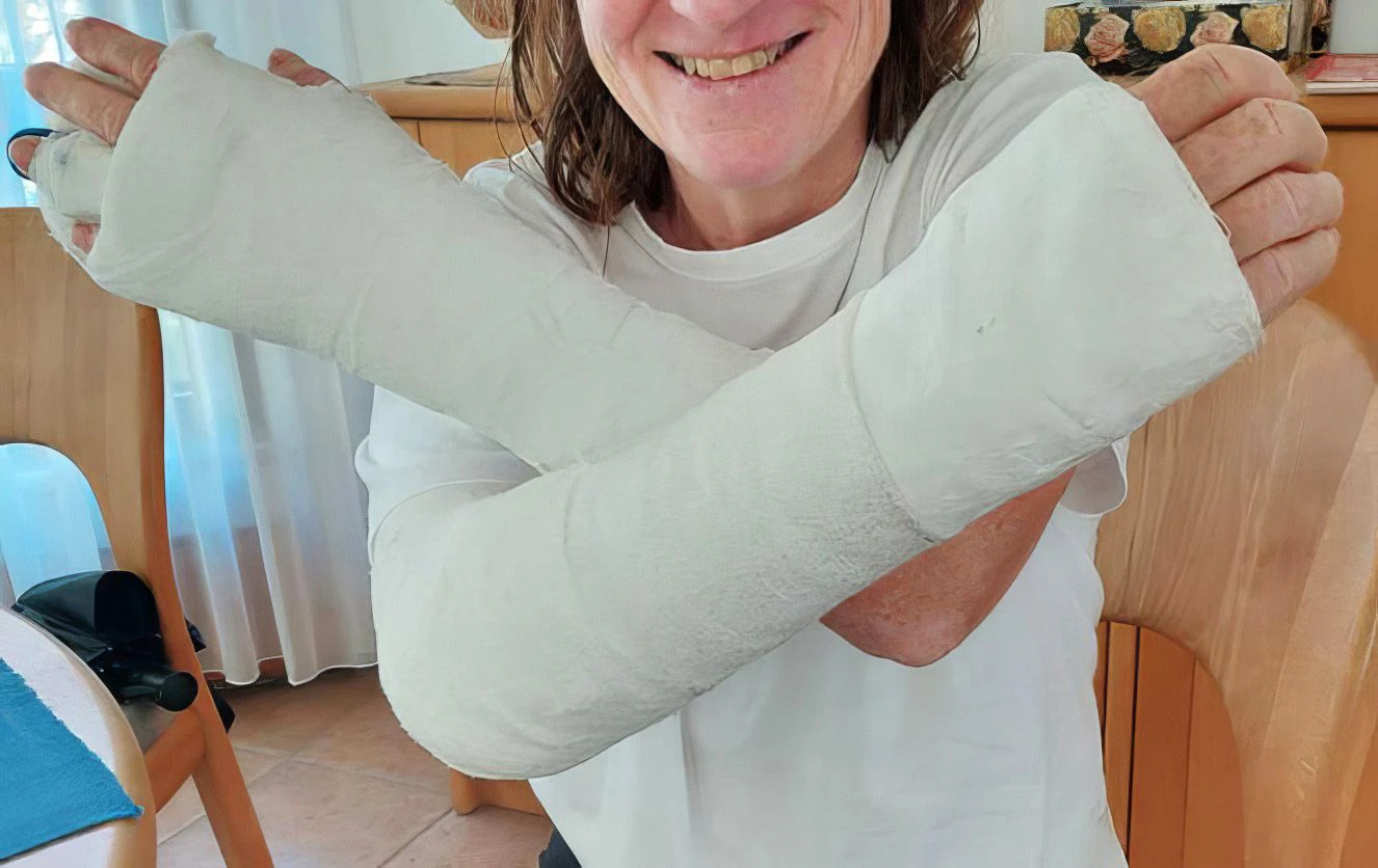 Karin S. hat sich nach einem Radunfall beide Arme gebrochen. 