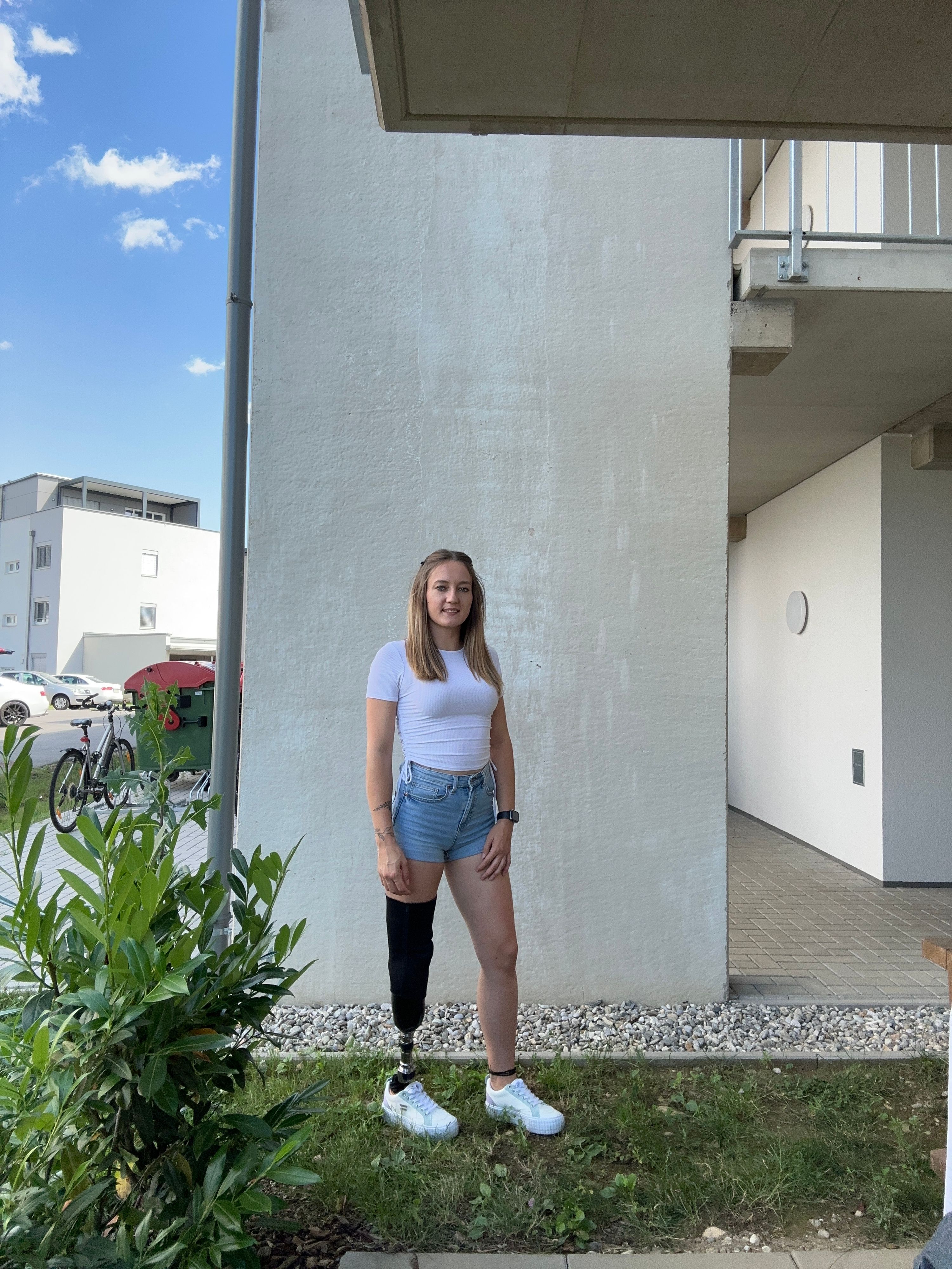 Katja P. musste nach einer Krebserkrabkung das Bein amputiert werden.