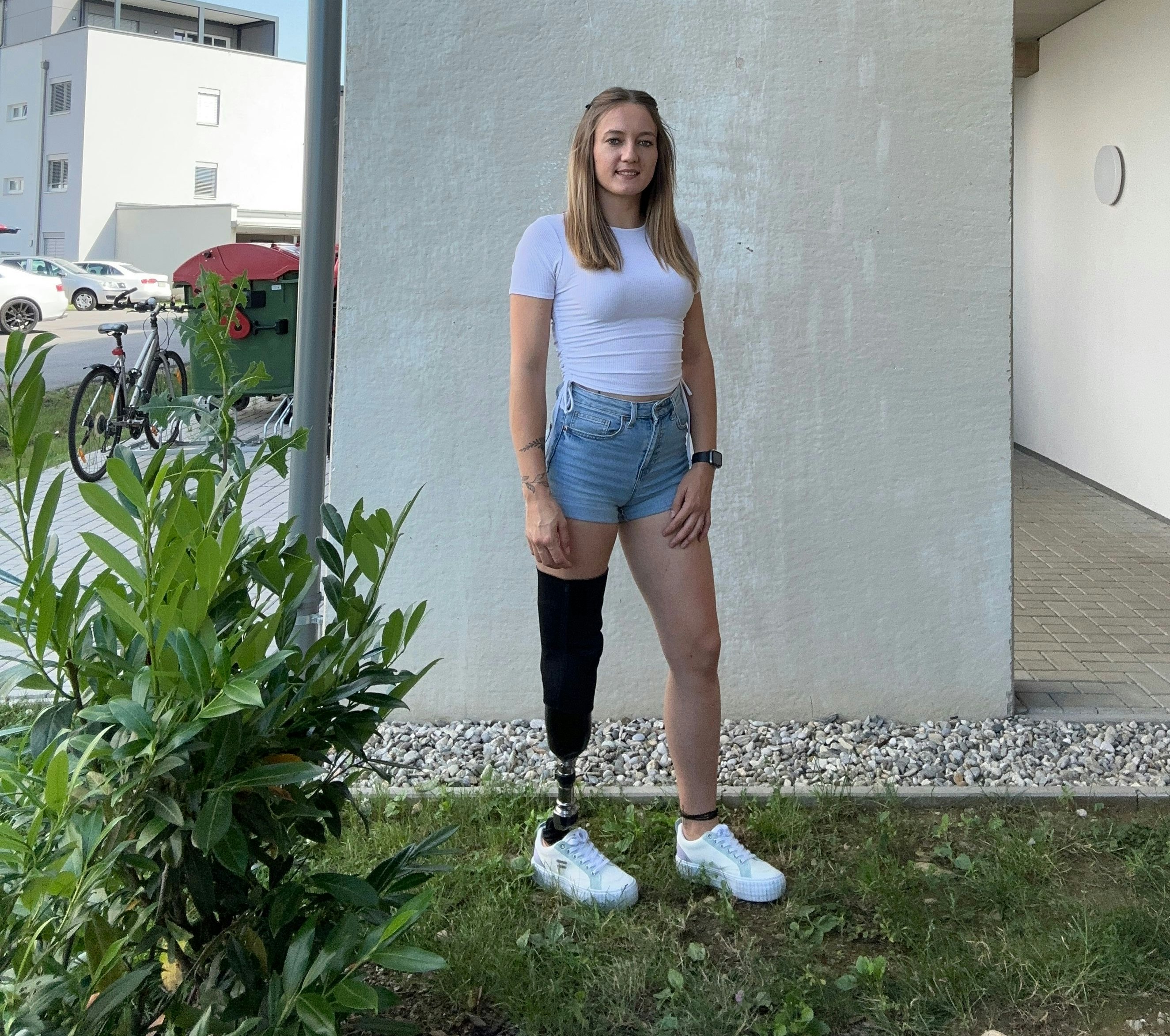 Katja P. musste nach einer Krebserkrabkung das Bein amputiert werden.