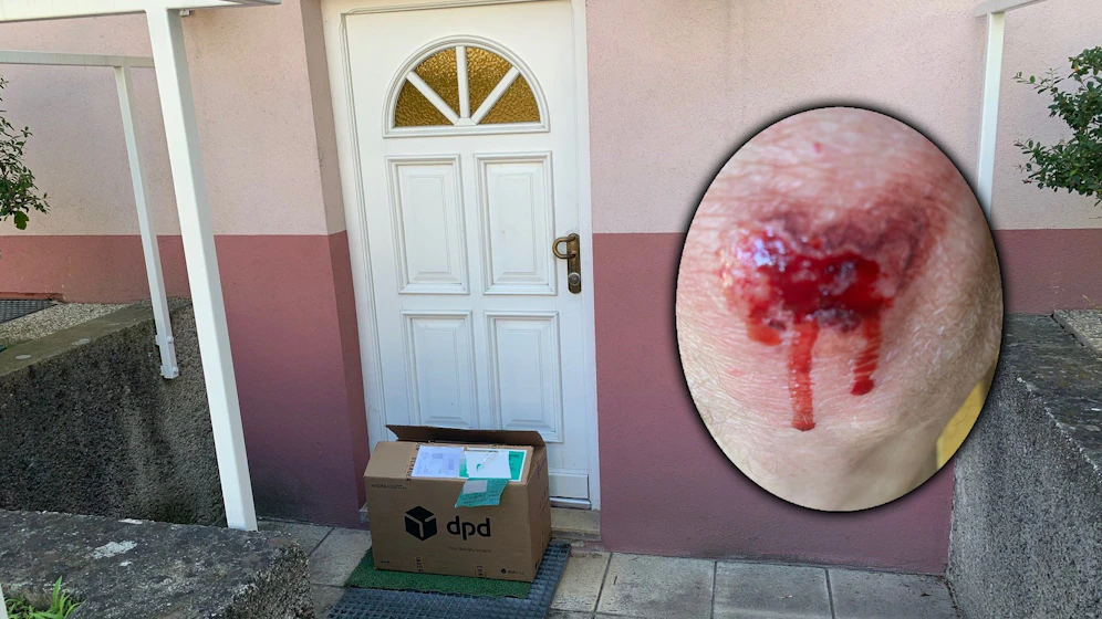 Tagelang wartete ein Wiener auf sein Paket – und stolperte folgenschwer drüber.