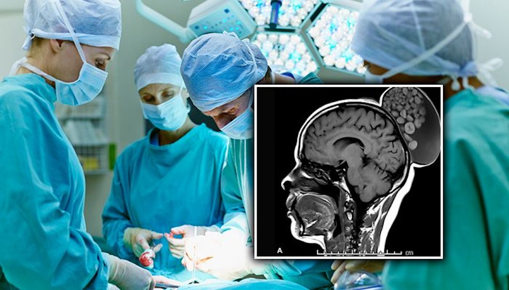 Auf dem Röntgenbild - hier klein im Foto - sind die 