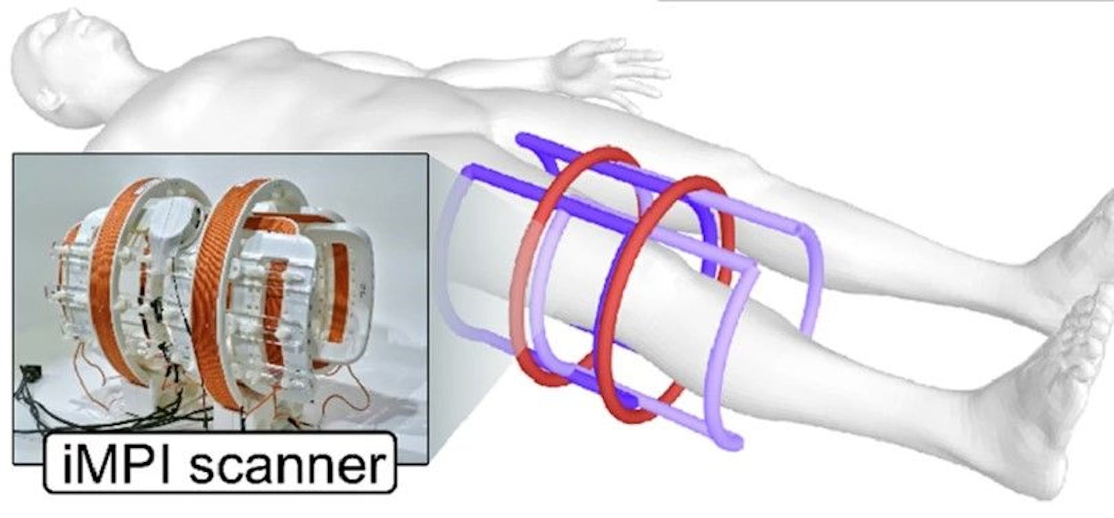 Der iMPI-Scanner ist so klein und leicht, dass man ihn mitnehmen und fast überall einsetzen kann.