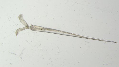 Ein Exemplar der Schnecke unter dem Mikroskop…