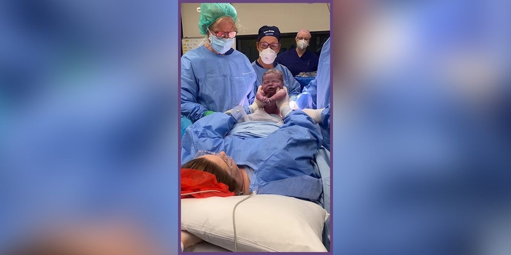 Mit dem mütterlich assistierten Kaiserschnitt (Bild) hat man eine Möglichkeit gefunden, der Mutter eine wichtige Rolle im Geburtsprozess zu geben.