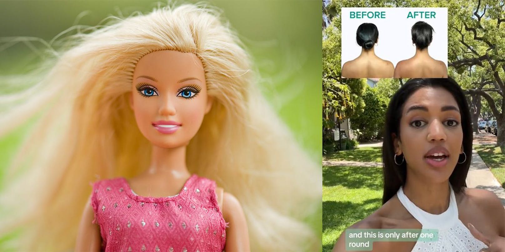 "Barbie": Diesen Körperteil lassen sich Frauen nun botoxen