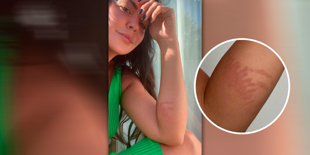 Martina Reuter hat mit Schmerzen zu kämpfen.