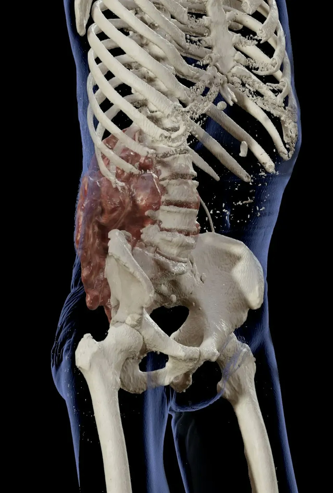 Heute.at - Sensations-OP rettet Familienvater (42) das Leben