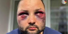 AfD-Politiker (35) auf dem Heimweg brutal verprügelt