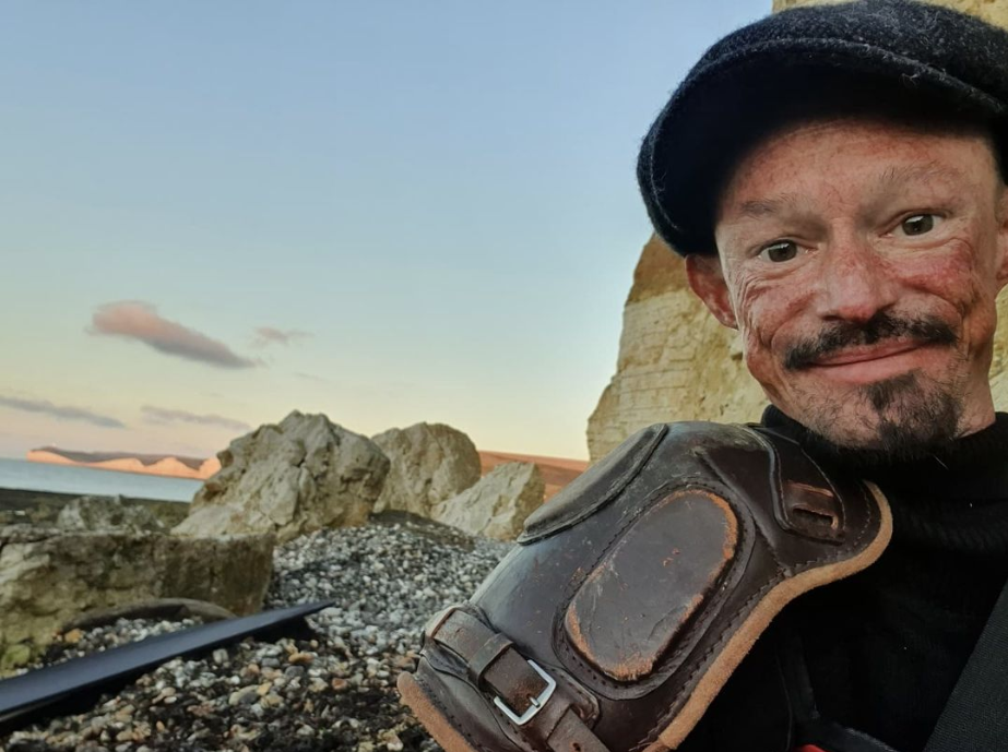 Darren Kent litt an&nbsp;mehreren chronischen Gesundheitsproblemen, darunter Arthritis, Osteoporose und einer seltenen Hautkrankheit.