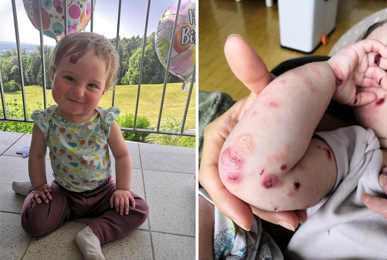 Kleine Lilijana ist ein Schmetterlingskind