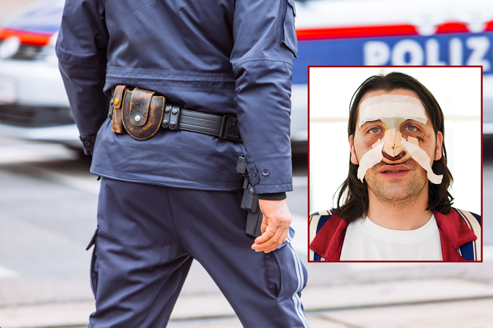 Der Mann tauchte mit schweren Verletzungen bei einer Polizeiinspektion auf. (Symbolbilder)