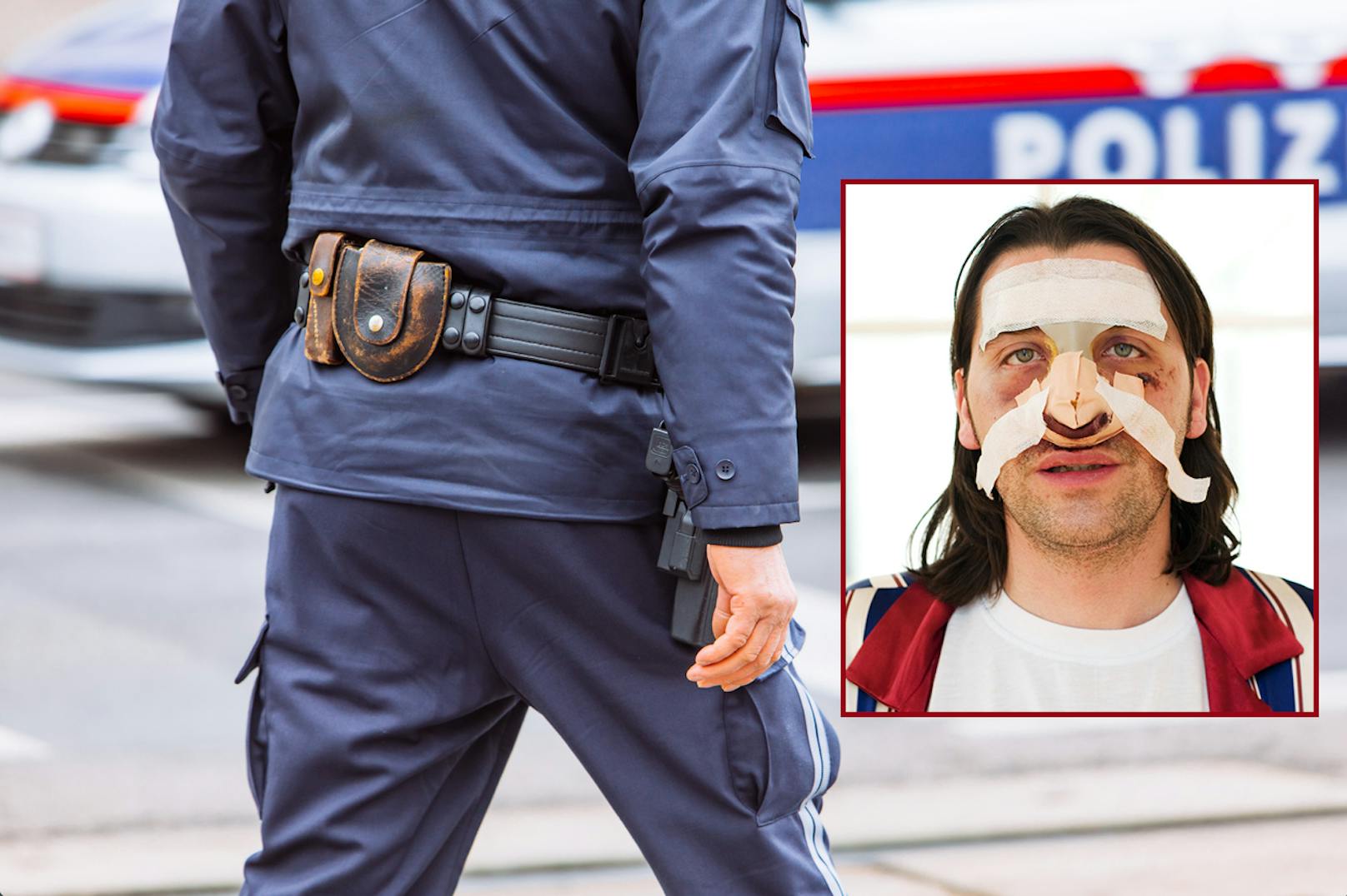 Schaurig – Mann ohne Nase gibt der Polizei Rätsel auf