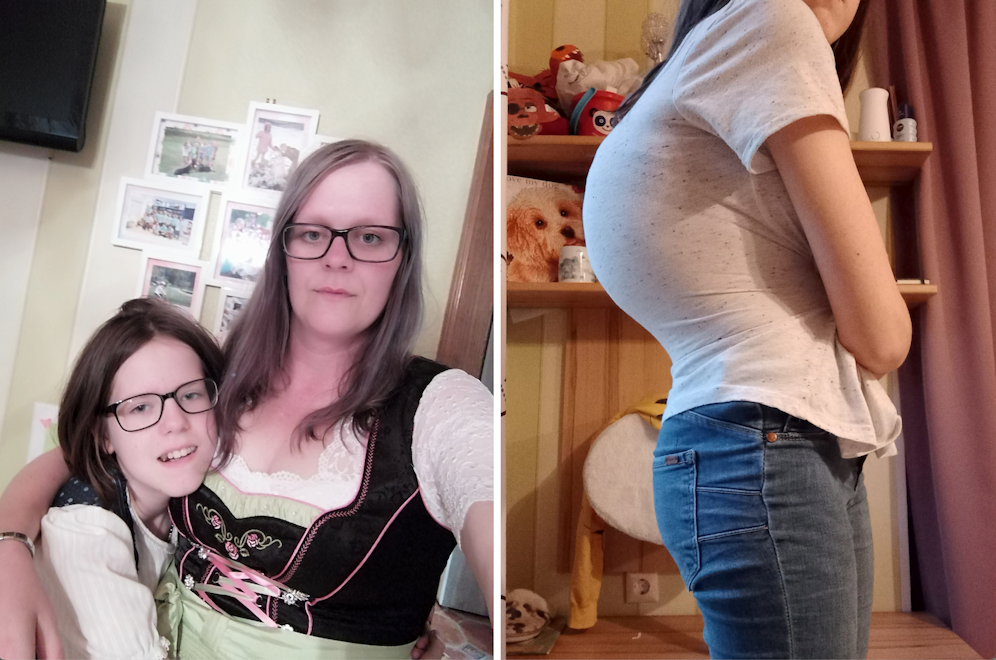 Leonie (l. mit Mama Lisa) hat starke Skoliose, nun wird ihre Wirbelsäule wieder begradigt-