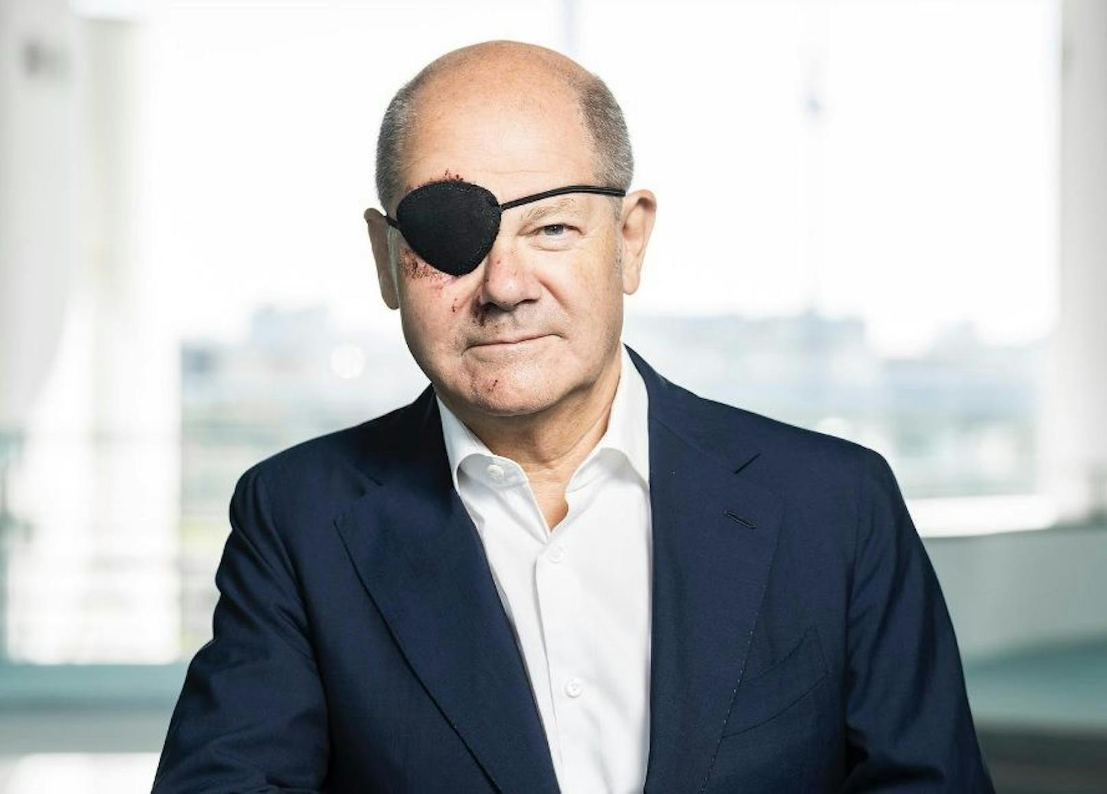 Der deutsche Kanzler Olaf Scholz trägt nach einem Sturz beim Joggen eine Augenklappe.