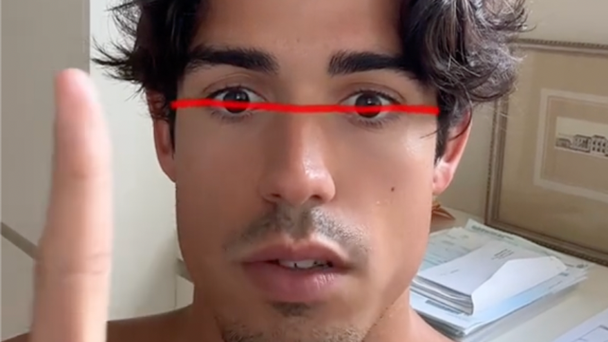 Anhand der Neigung der Augen soll sich erkennen lassen, ob eine Person schön ist oder nicht.