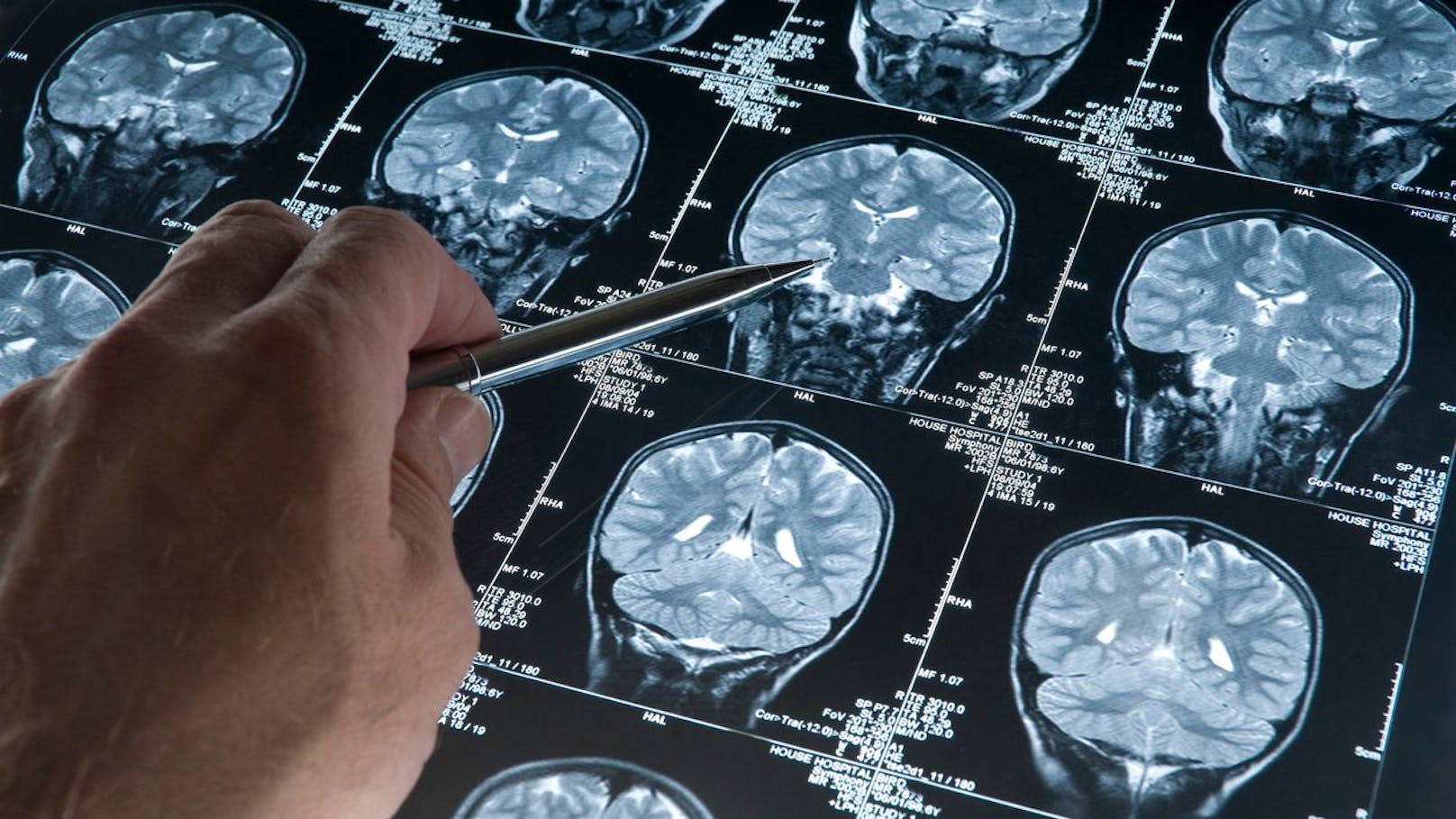 Neue Forschung: Menschliche Gehirne werden immer größer