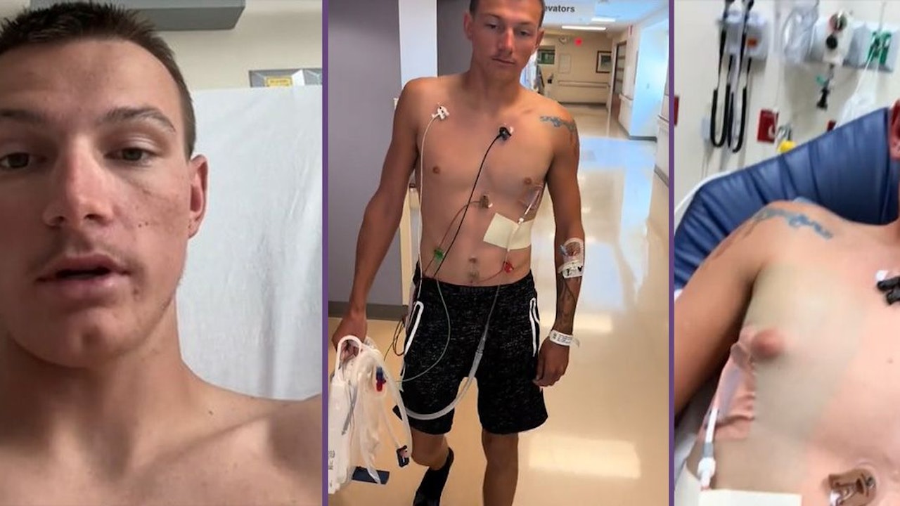 Heute.at - Mann raucht sich mit Vapes Loch in die Lunge